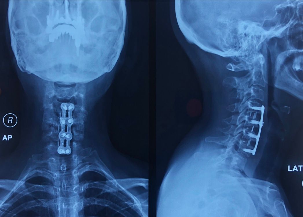 Gisela Cleto Zepeda-134