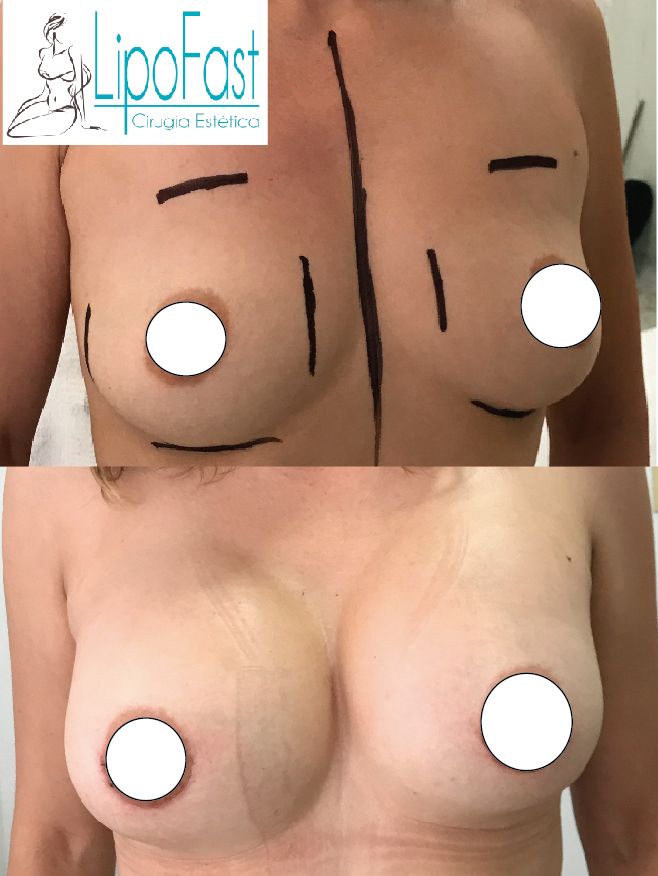 J. Antonio Meré Gómez-6