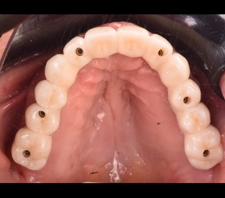 Carlos Ernesto Contreras Castellanos-20