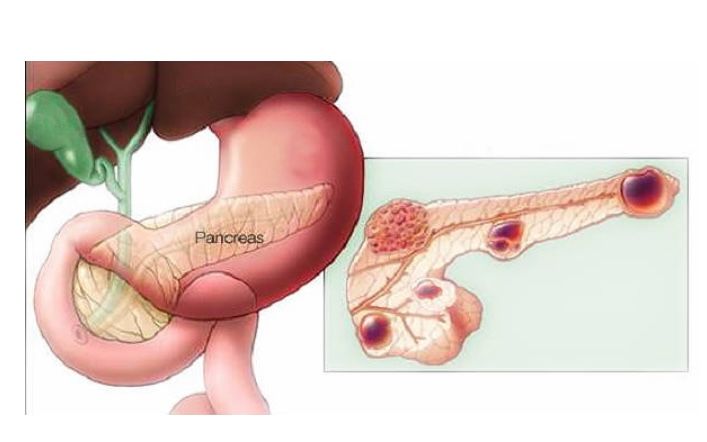 Carlos Rodríguez Montalvo-17