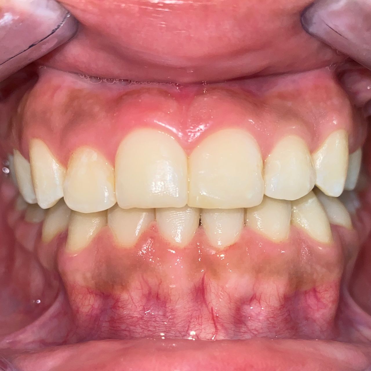 María Guadalupe García Figueroa-7