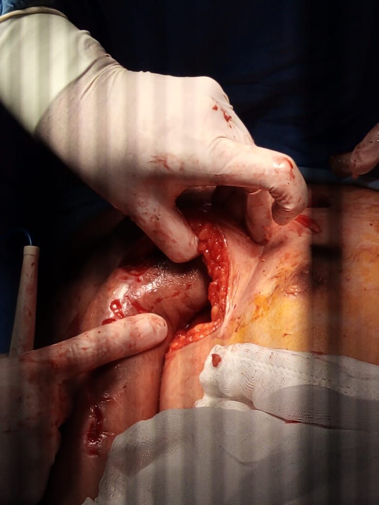 Federico Quintana De La Rosa-48