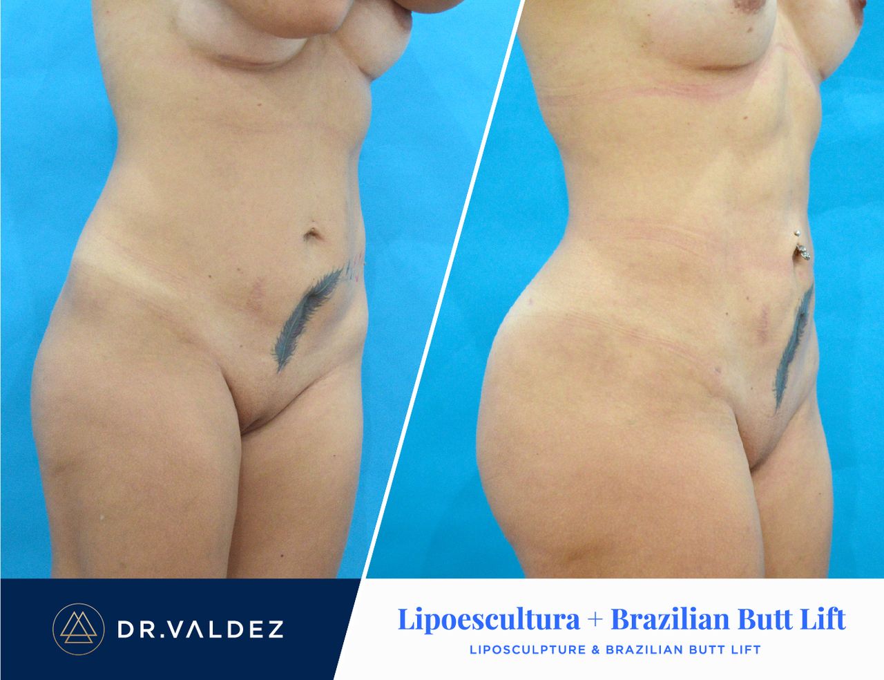 Pedro Arturo Valdez Gomez-20