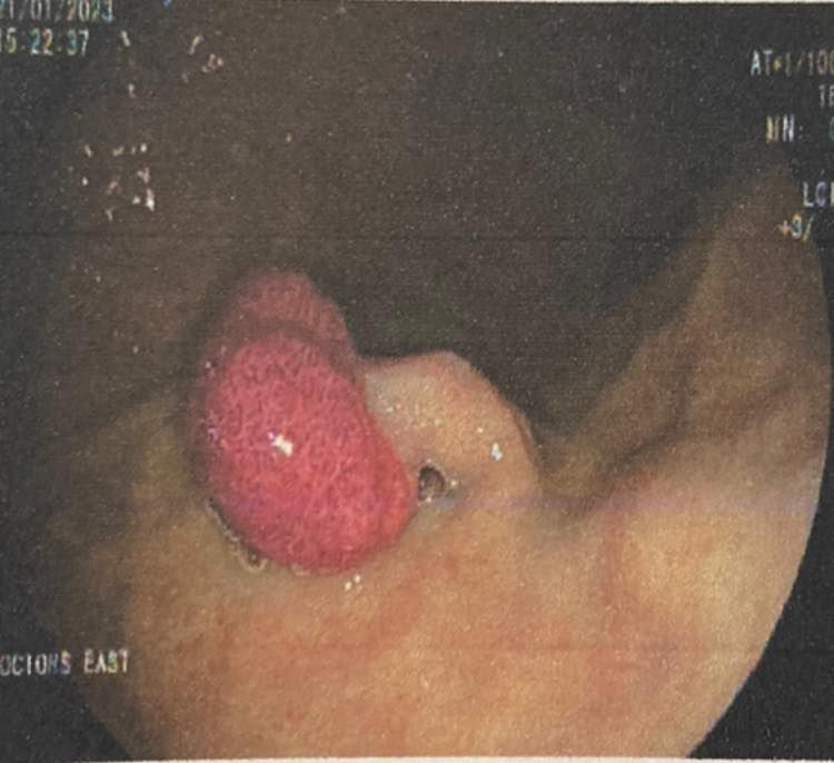 J. César Reyes Vásquez-6