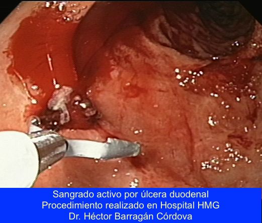 Héctor Hugo Barragán Córdova-0