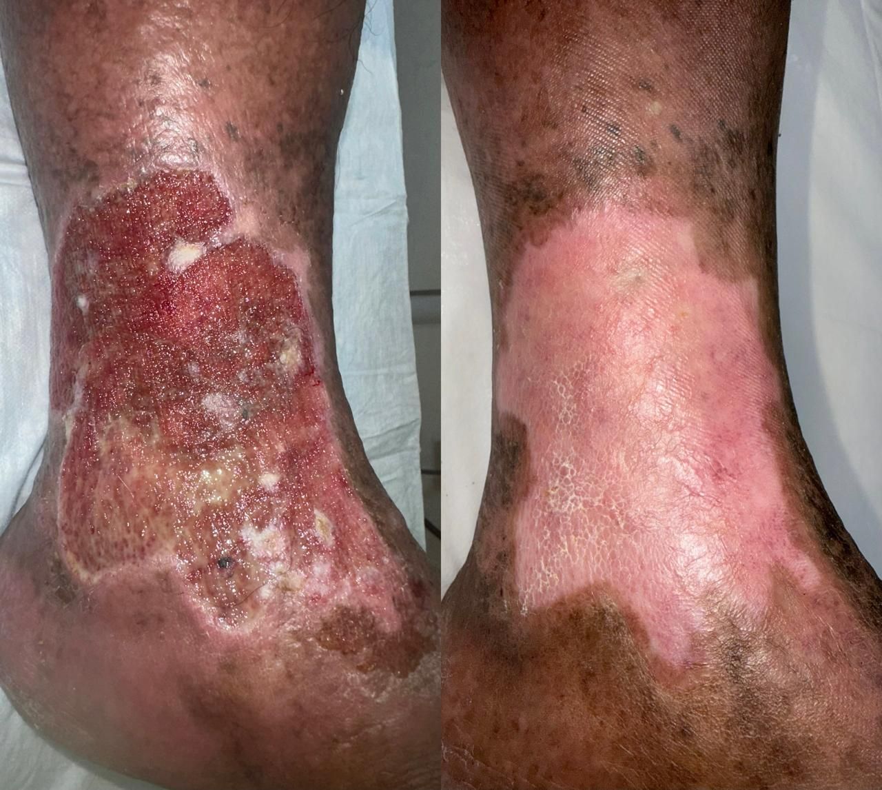 Jhonatan López González-19