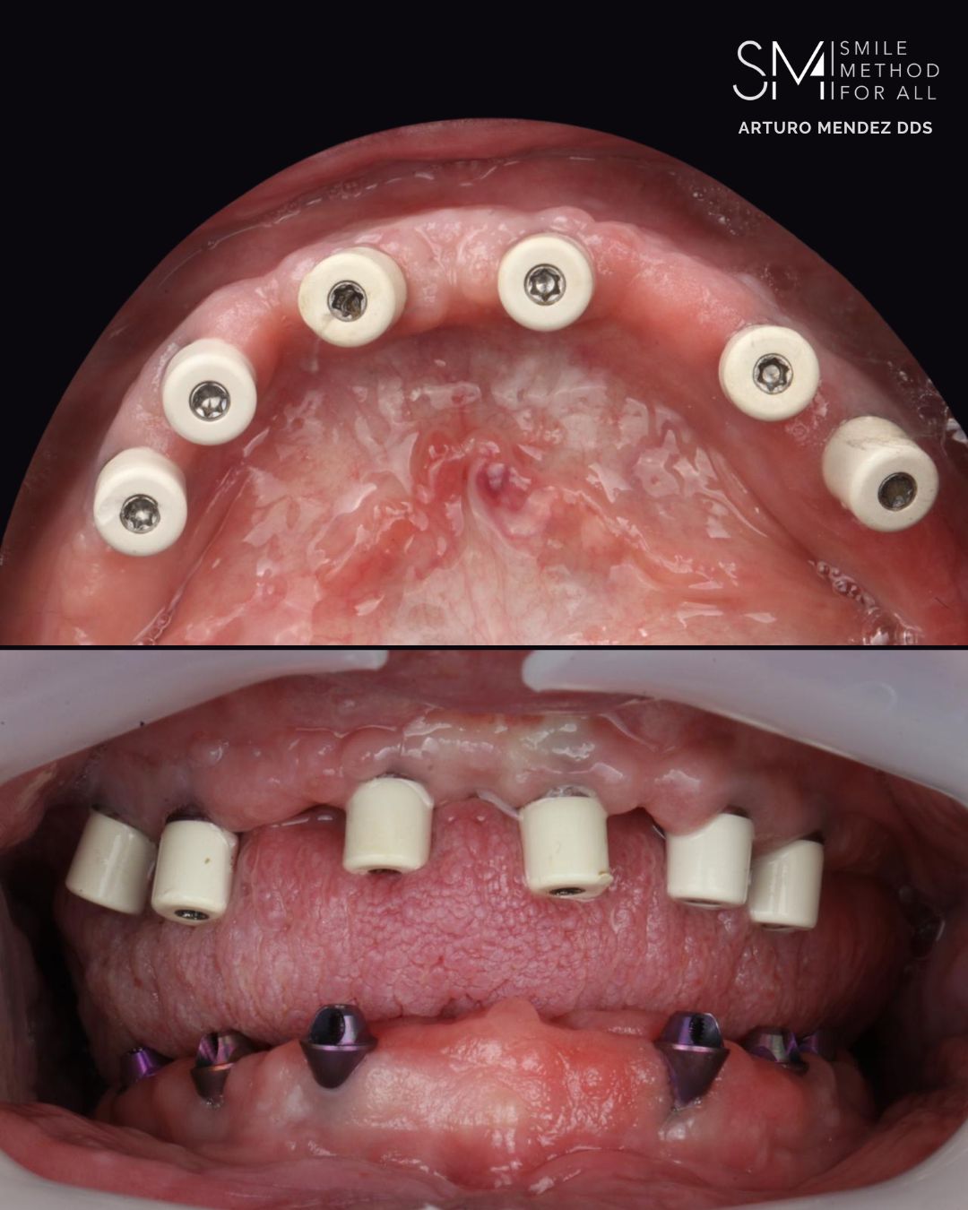 Arturo Mendez Valencia-28