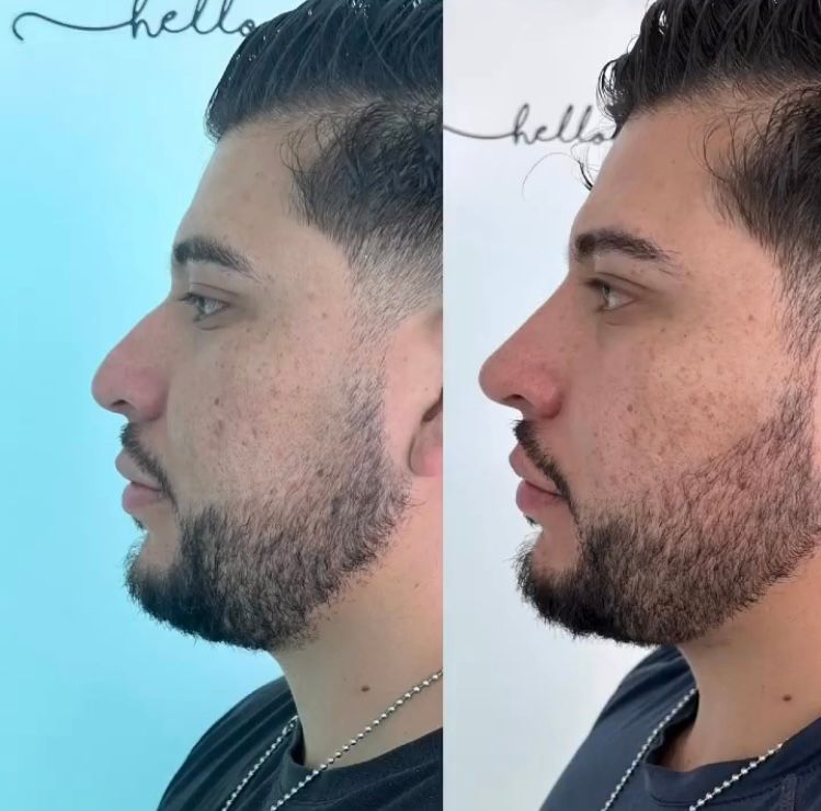 Balbina San Lorenzo Diaz-4