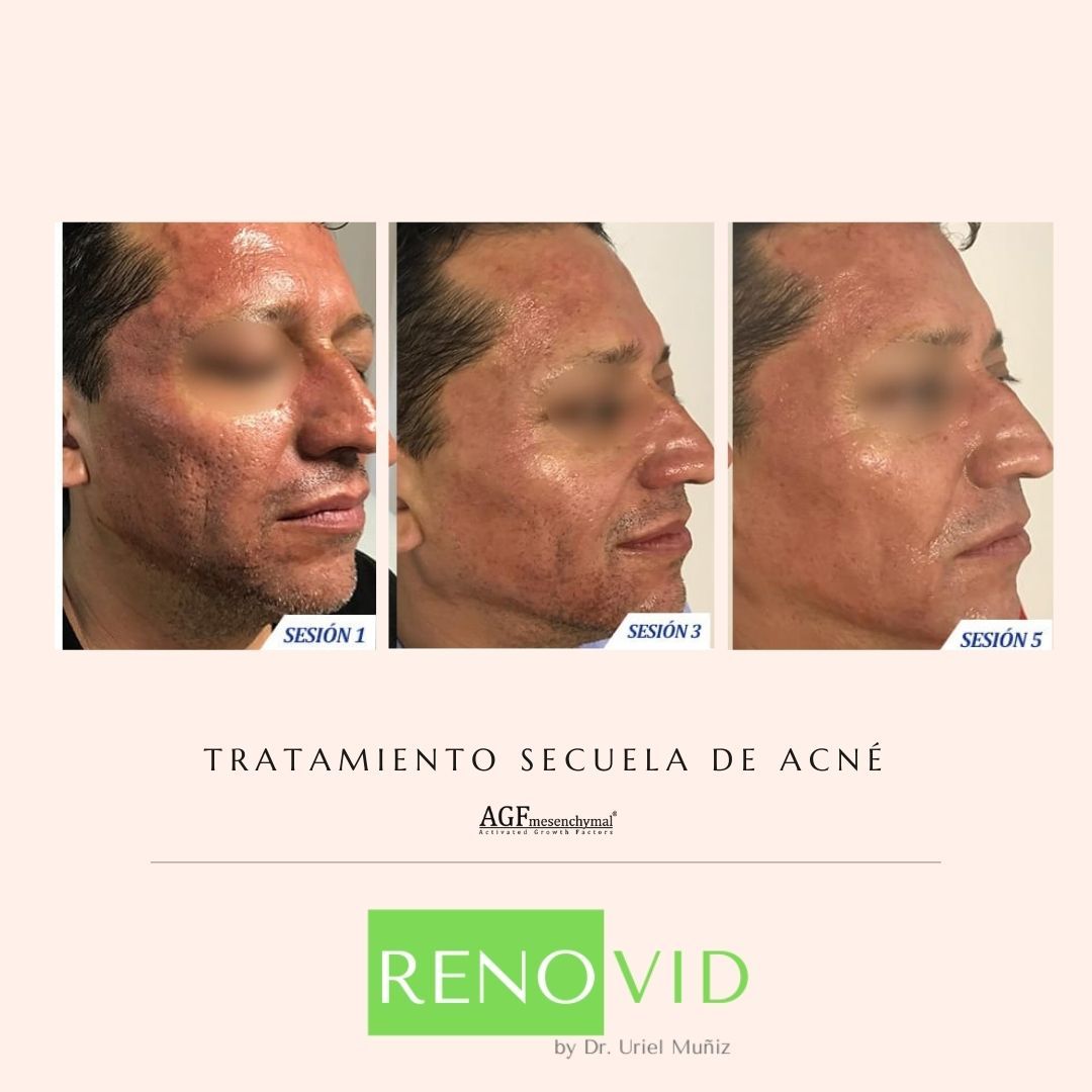 Teófilo Uriel Muñiz Chávez-51