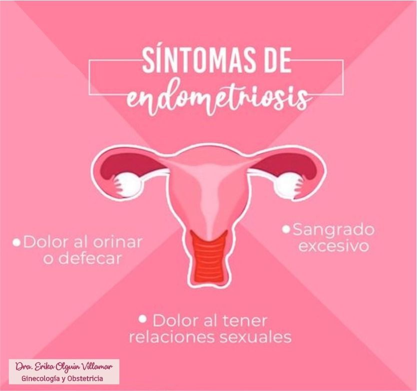 Erika Olguín Villamar-23