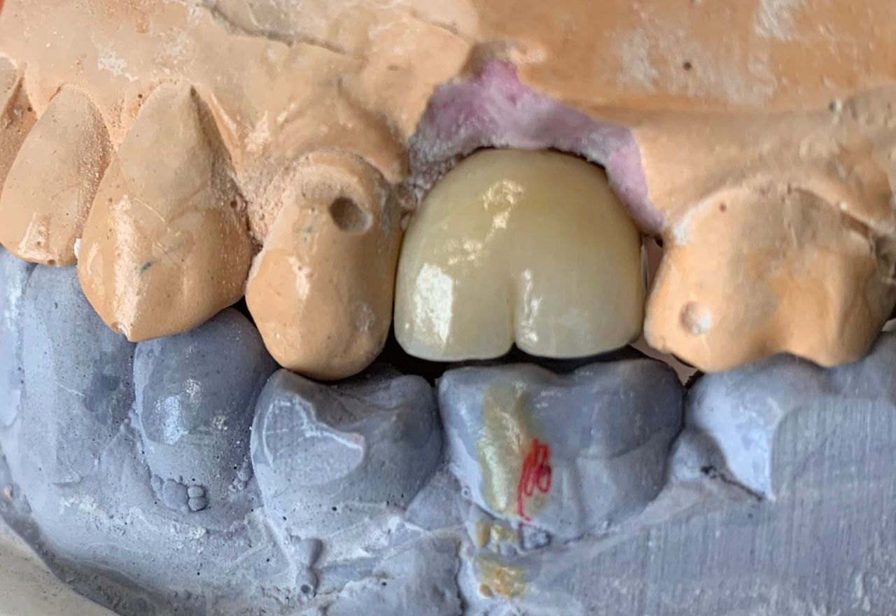 Alberto Miguel Rodriguez Soto-23