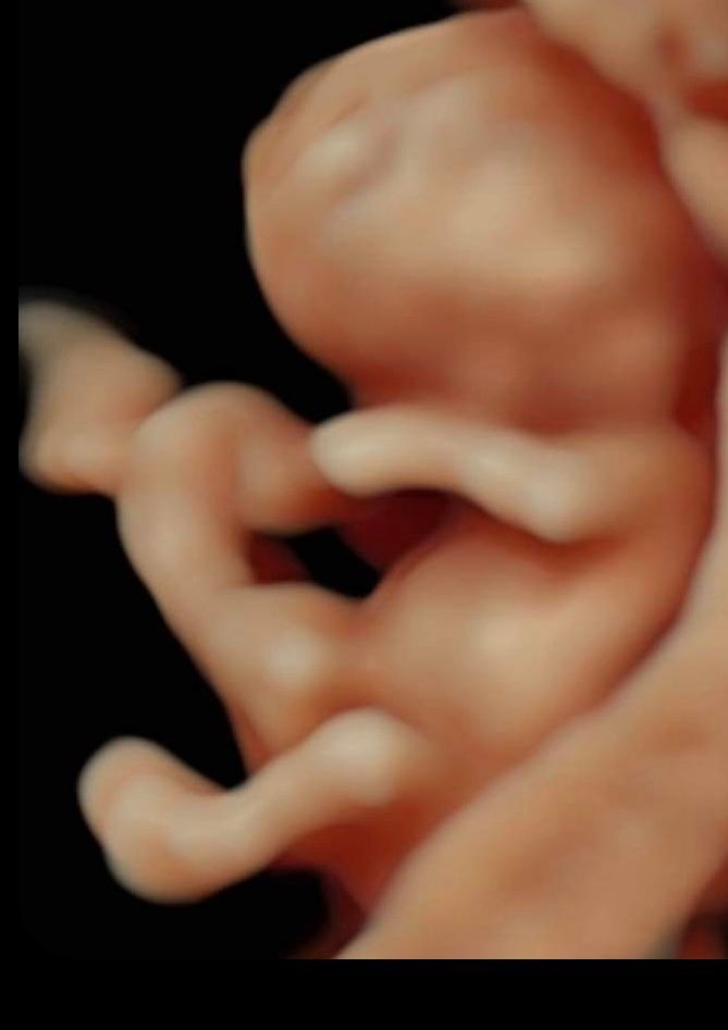 Nallely Moreno  Uribe-12