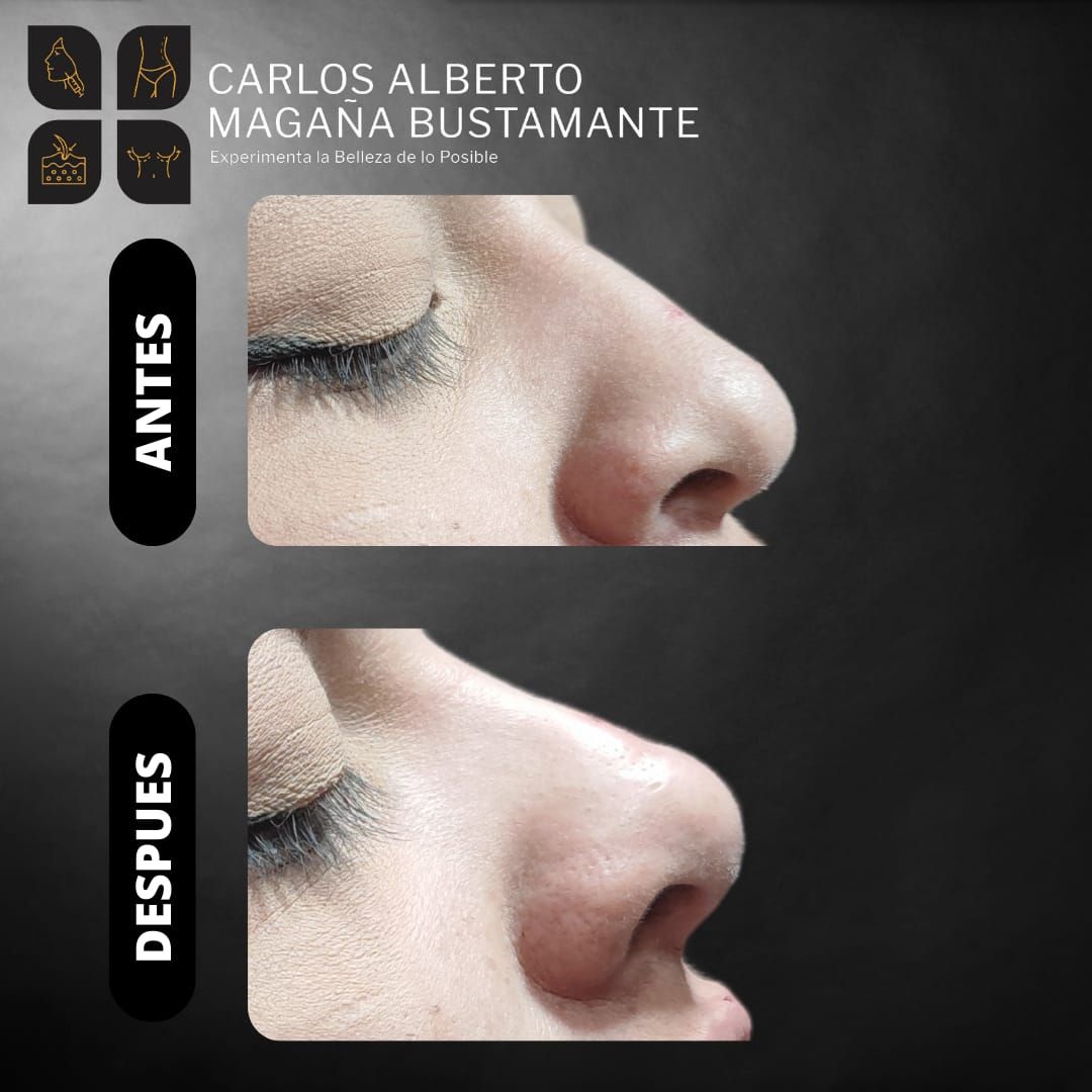 Carlos Alberto Magaña Bustamante-22