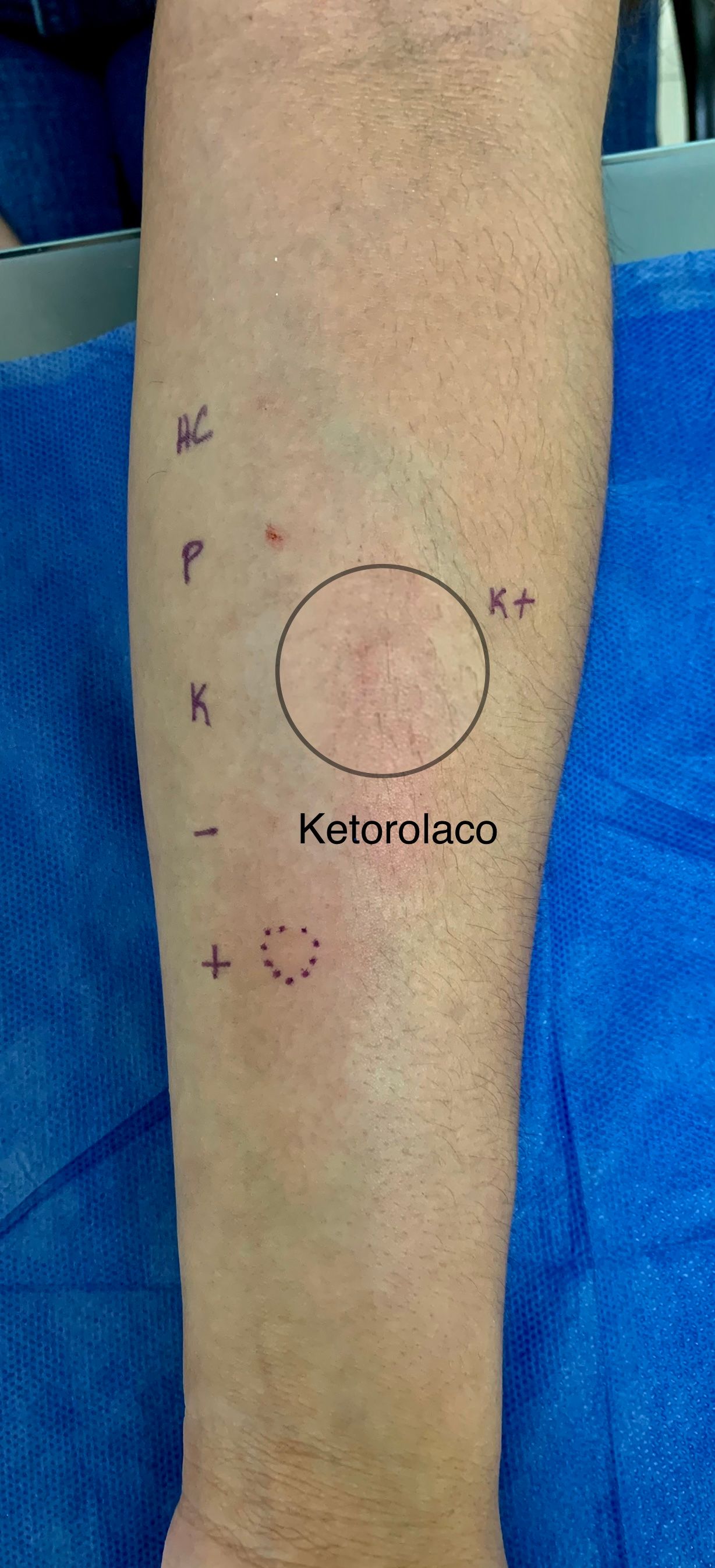 Arturo Gaspar López-6