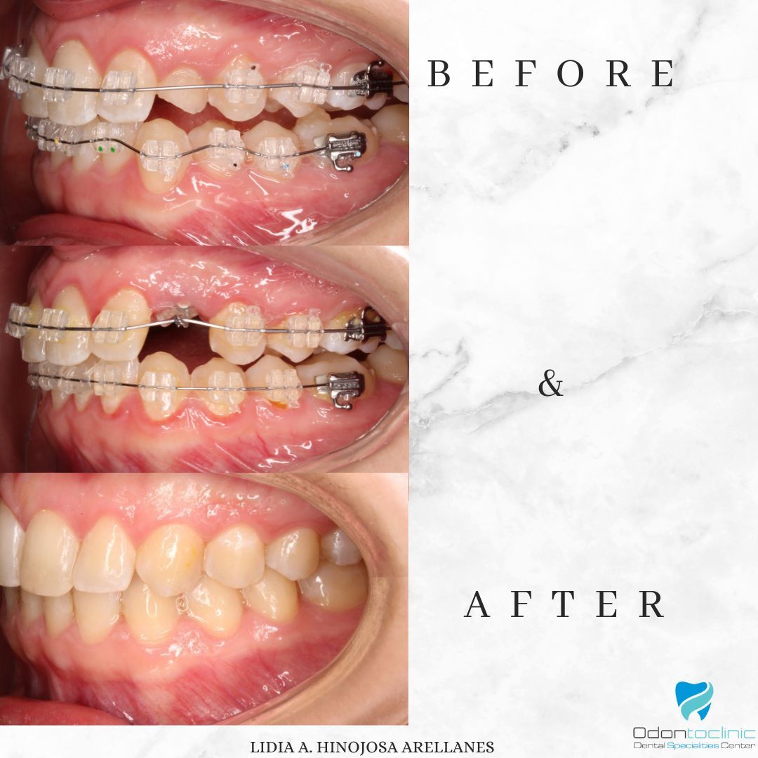 Lidia Abigail Hinojosa Arellanes-27