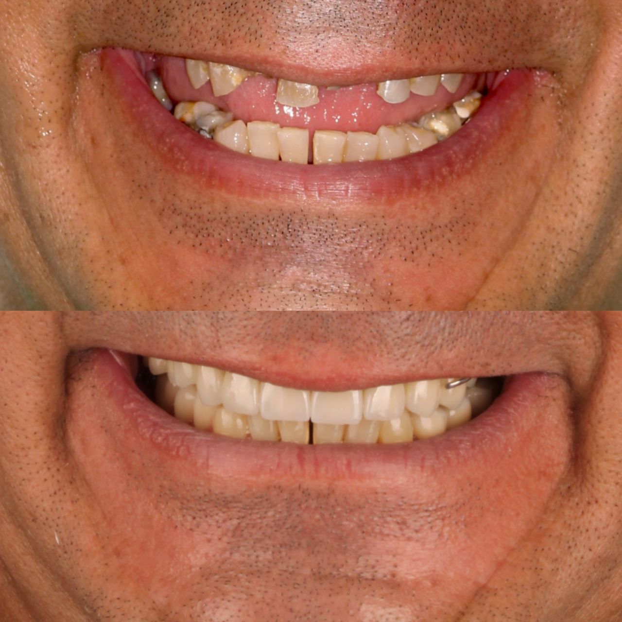 Miguel Alberto Escalona Mora-4