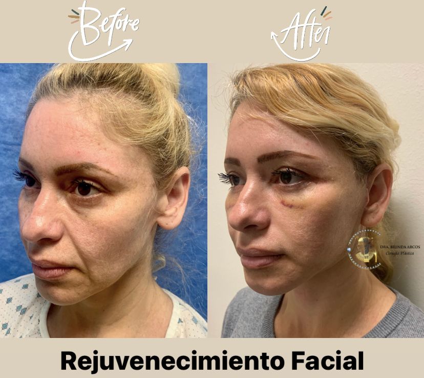 Brenda Arcos Vera-37