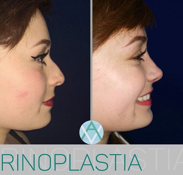 Alfonso Villaseñor Herrero-15