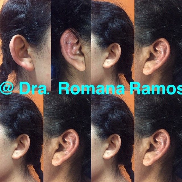 Romana Ramos Cárdenas-11