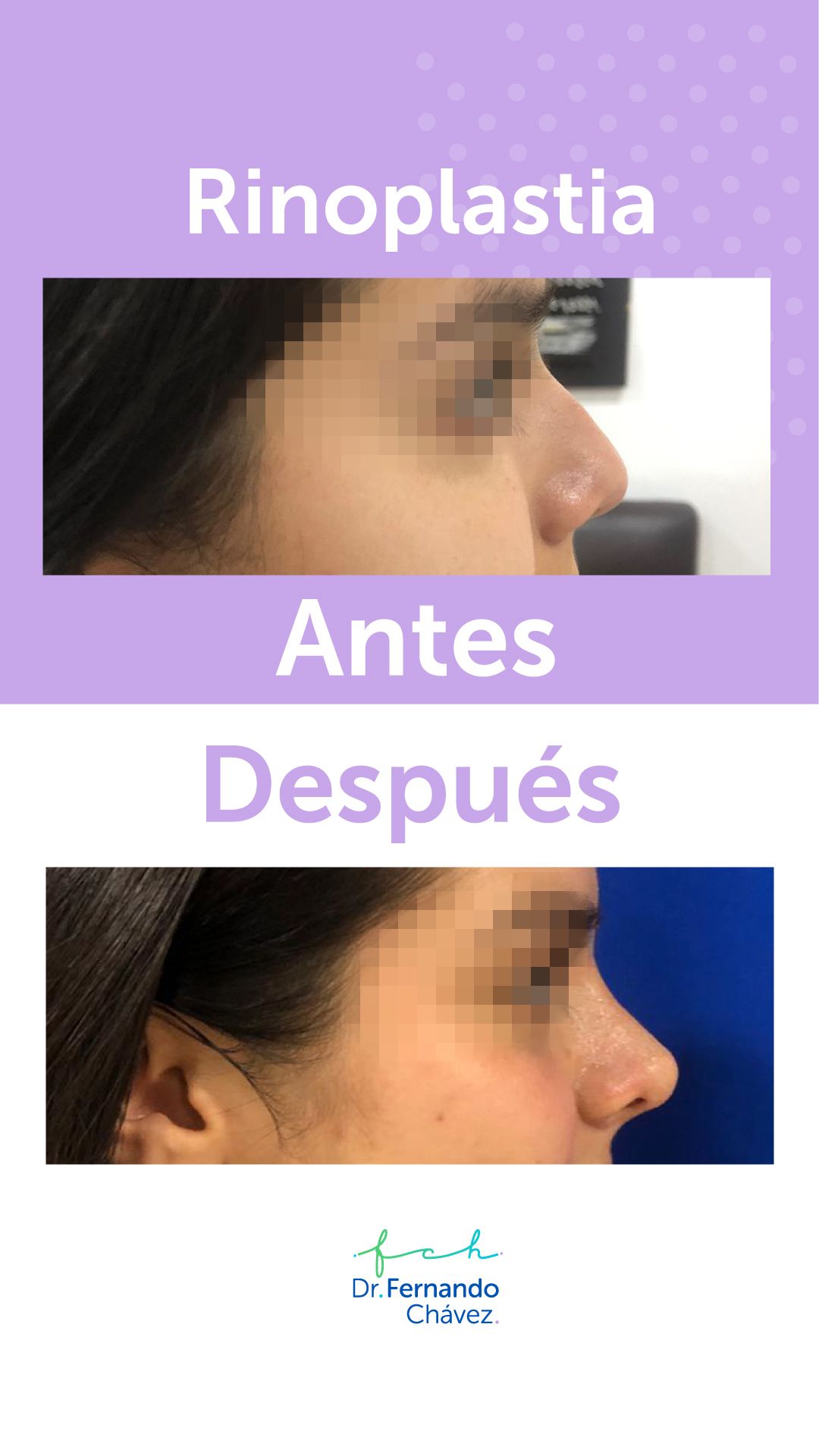 Fernando Chávez Osorio-6