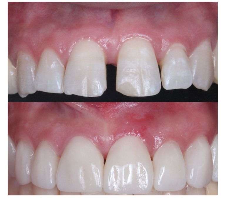 Erika Díaz De León Torres-7