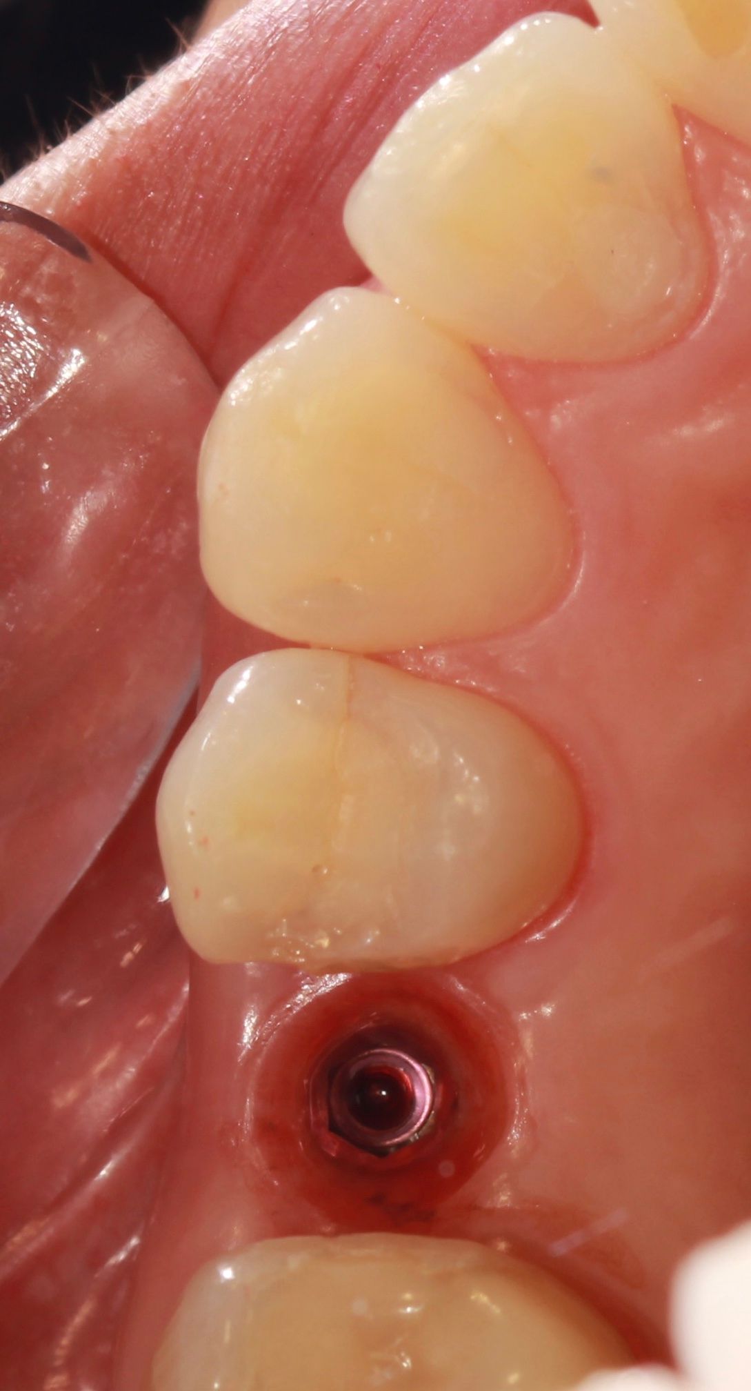 Jesus De La Cruz Ballinas-22