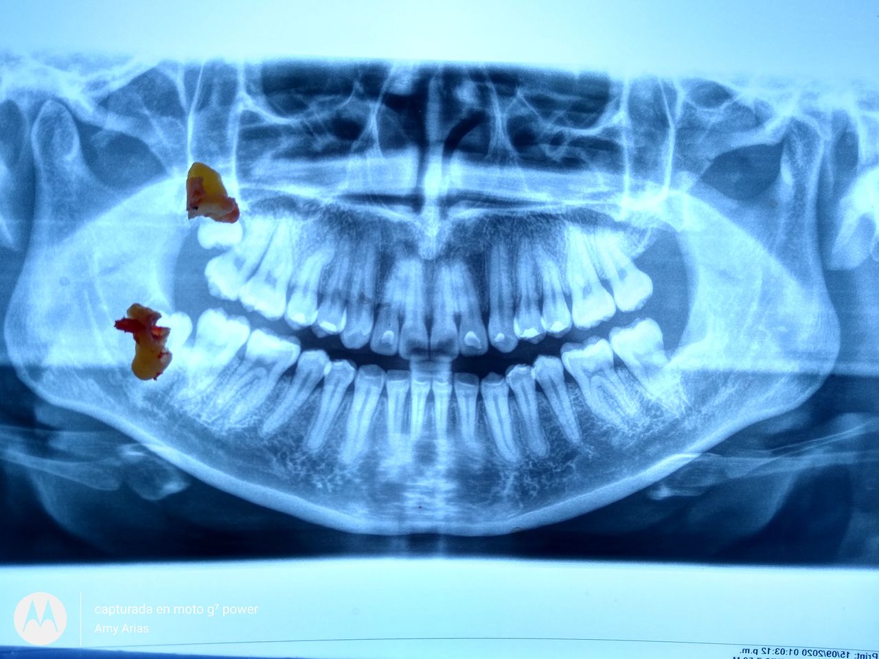 Ami A. Arias Morales-2