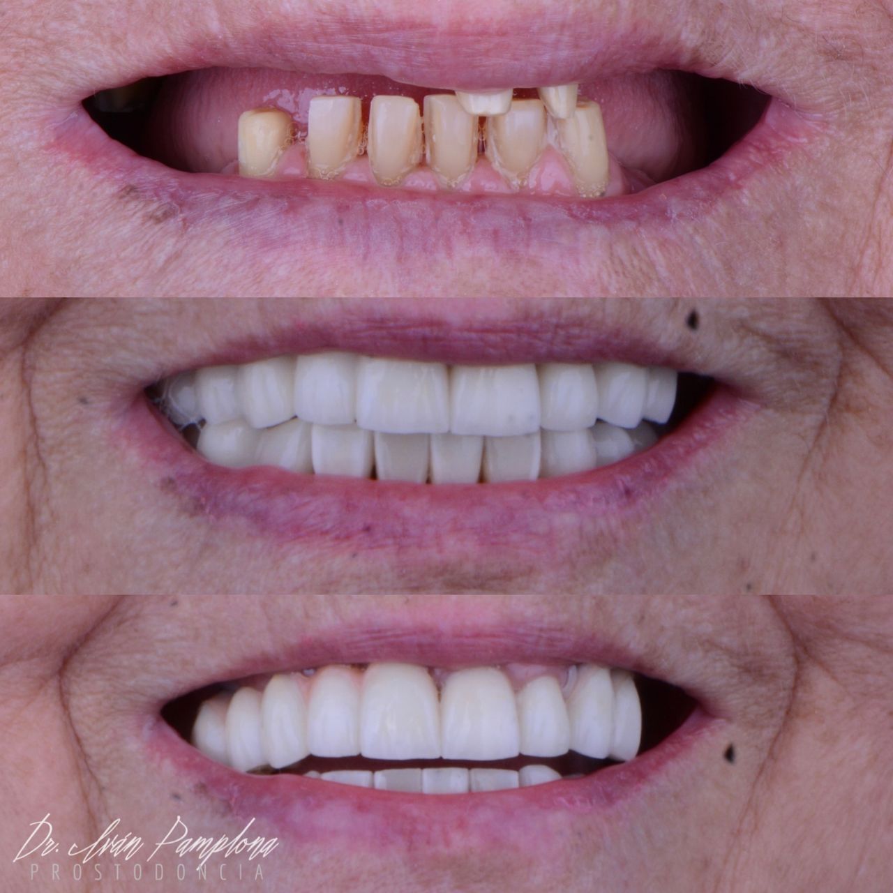 Iván Gerardo Pamplona Alfaro-16