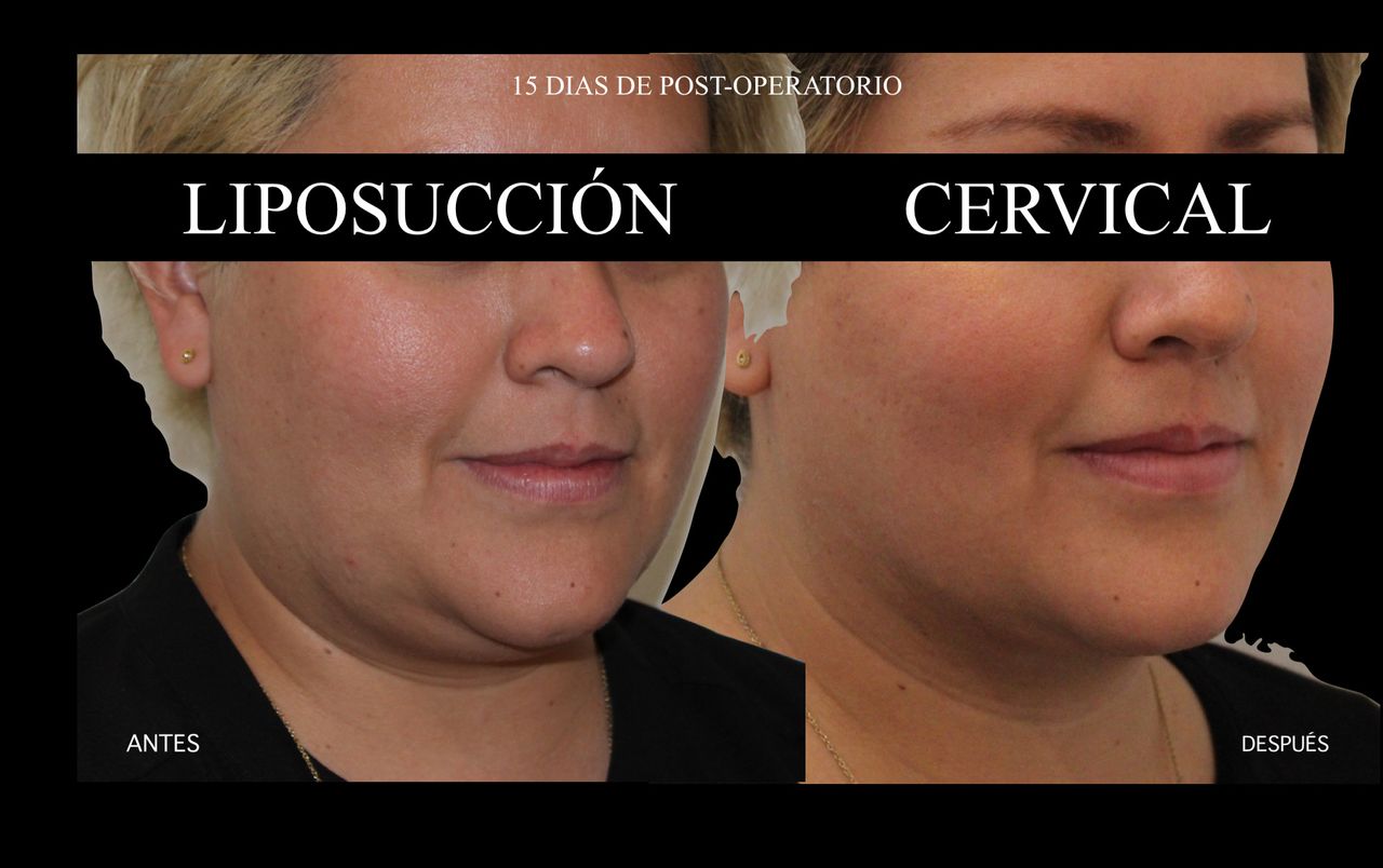 Giovani Ramírez Limón-15