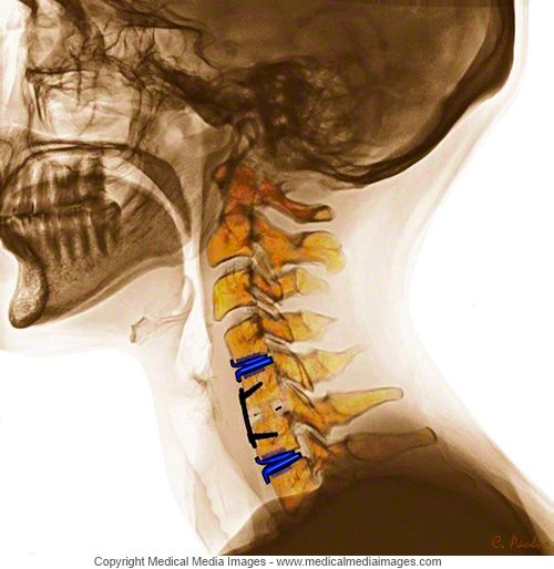 José Sayavedra Jaimes-39