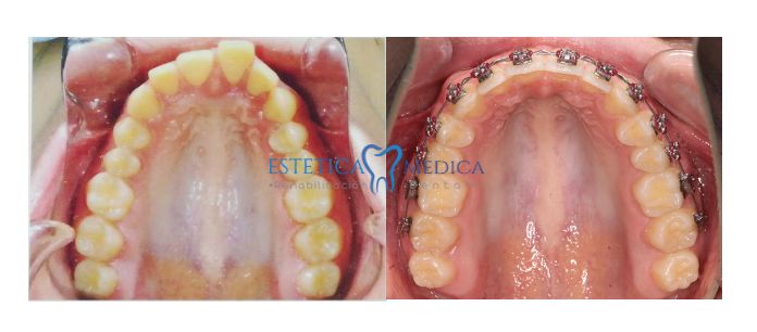 Bielmy Veronica Jonapa Peña-12