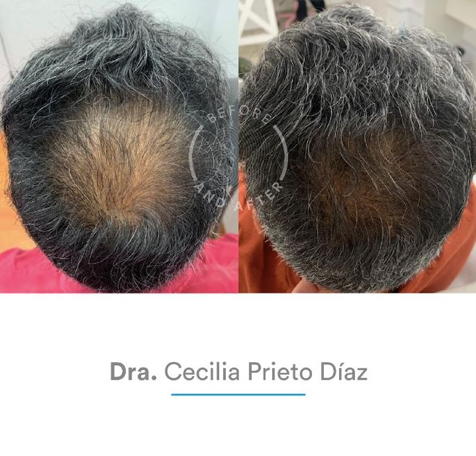 Alma Cecilia Prieto Diaz Preciado-42