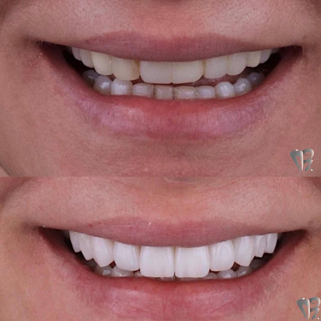 Ernesto Rojas Calderon-47