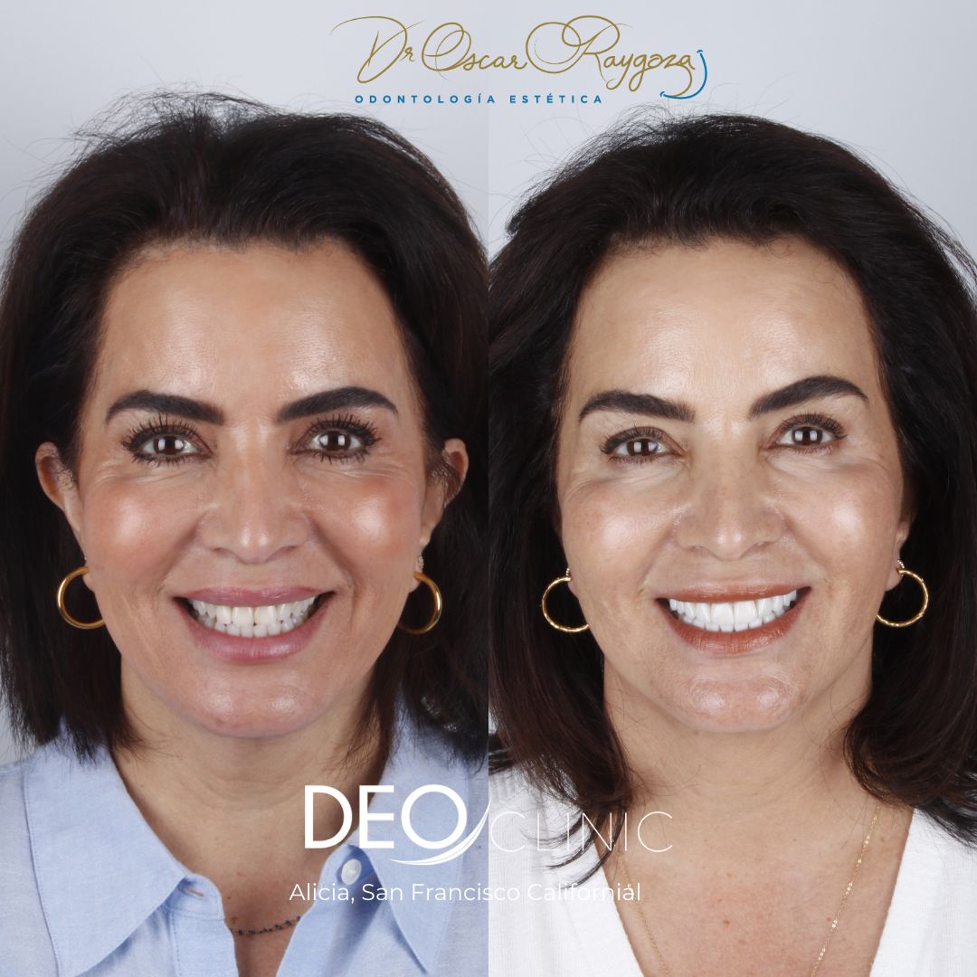 Oscar Raygoza Carrillo-31