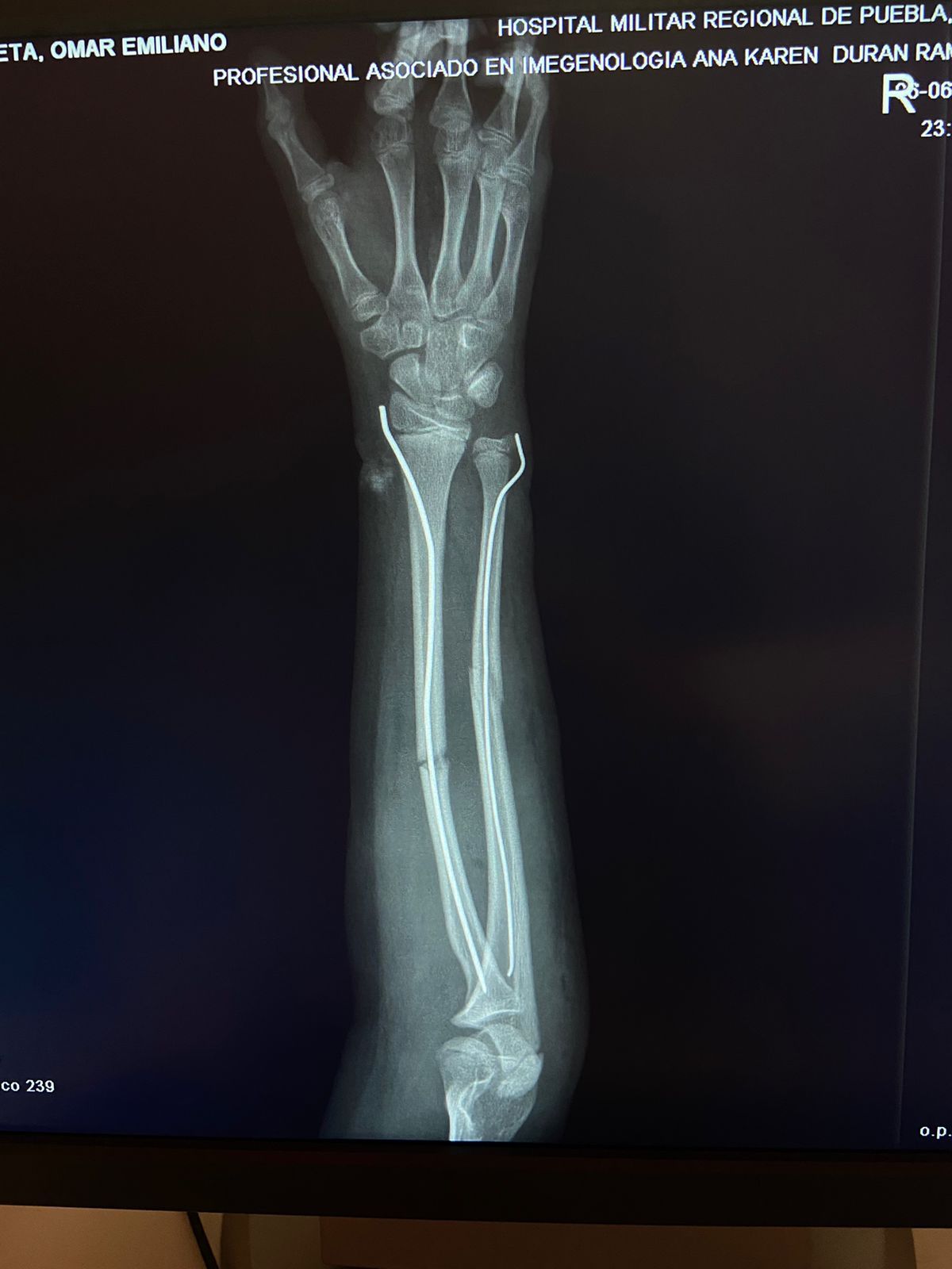 Oscar Francisco López Resinez-4