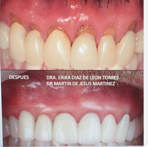 Erika Díaz De León Torres-14