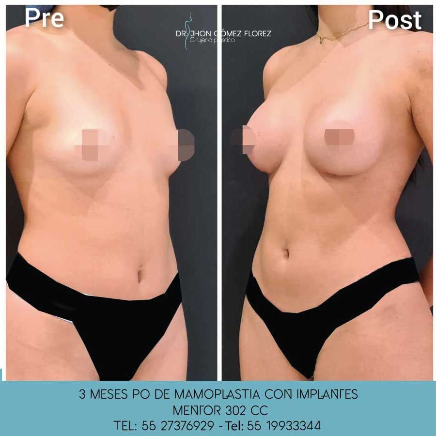 Jhon César Gómez Florez-10