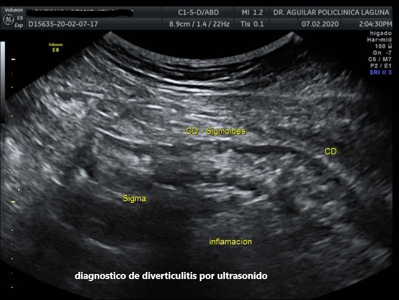 Edgar Fernando Aguilar Morales-9