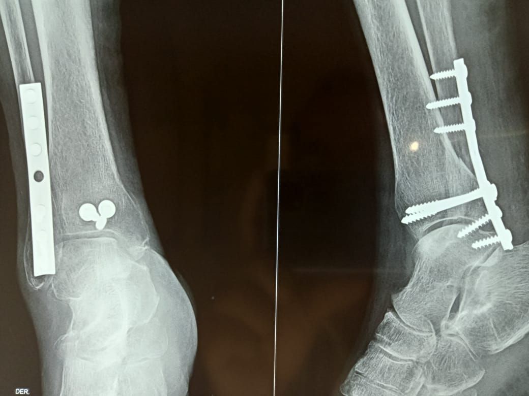 Carlos Alberto Lázaro Cubría-12