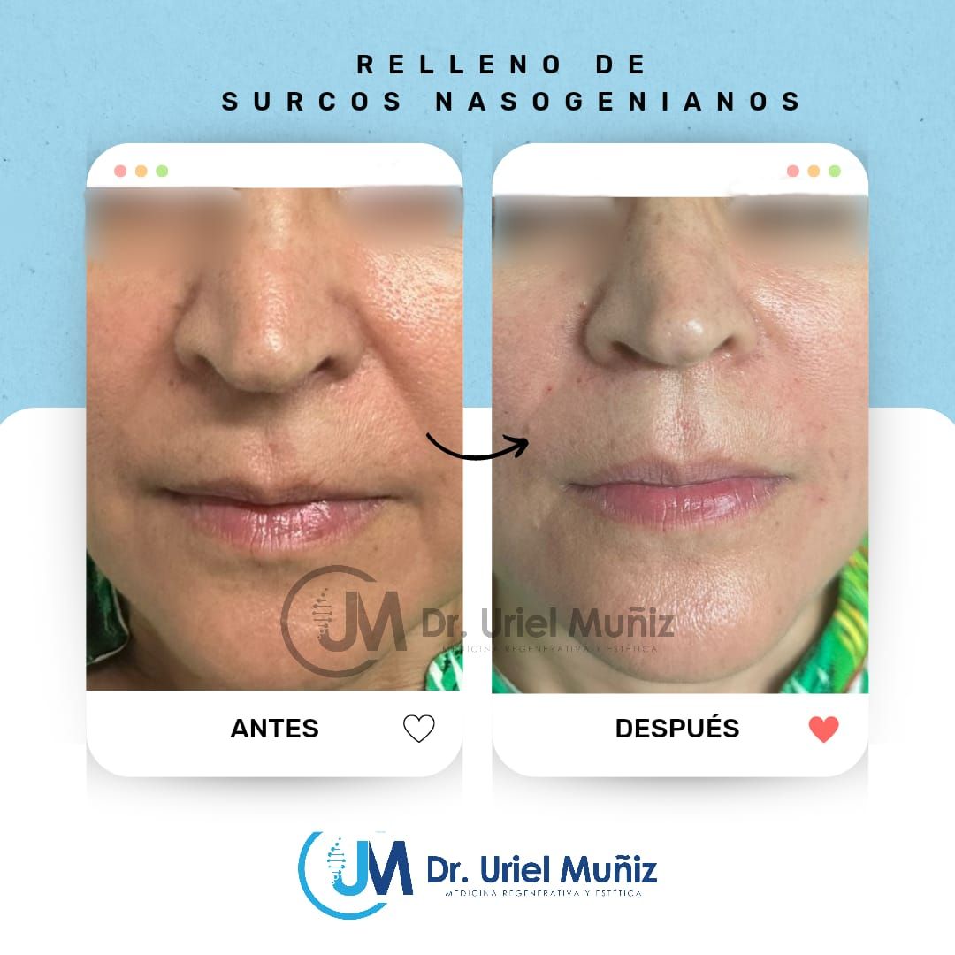 Teófilo Uriel Muñiz Chávez-36