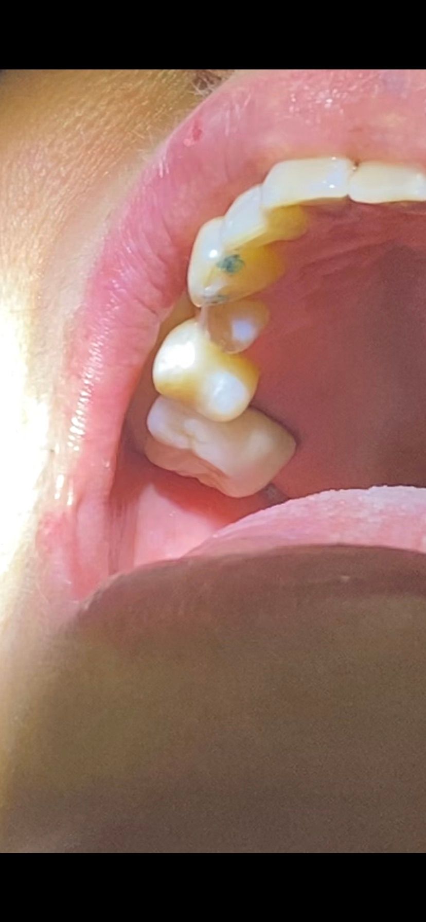 Raúl Méndez Cifuentes-23