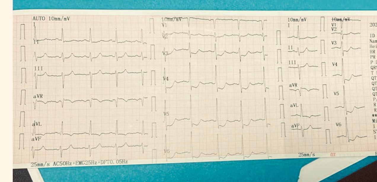 Abdón Ávila Chávez-7