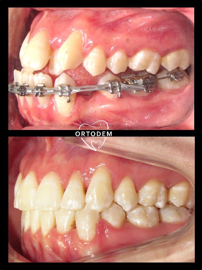 Elizabeth Morelos Morales-7