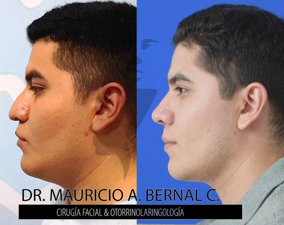 Mauricio Alejandro Bernal Carreon-22