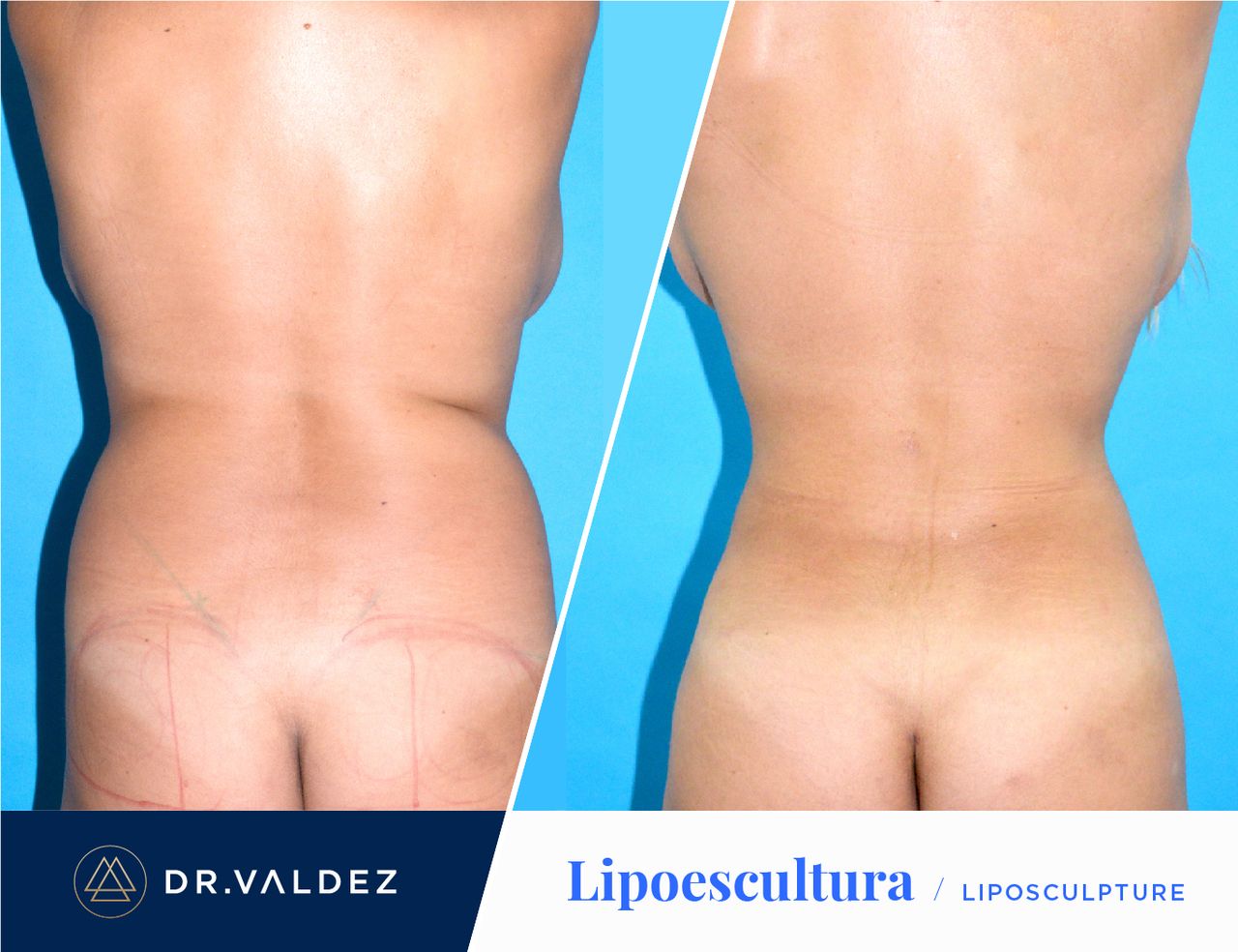 Pedro Arturo Valdez Gomez-17