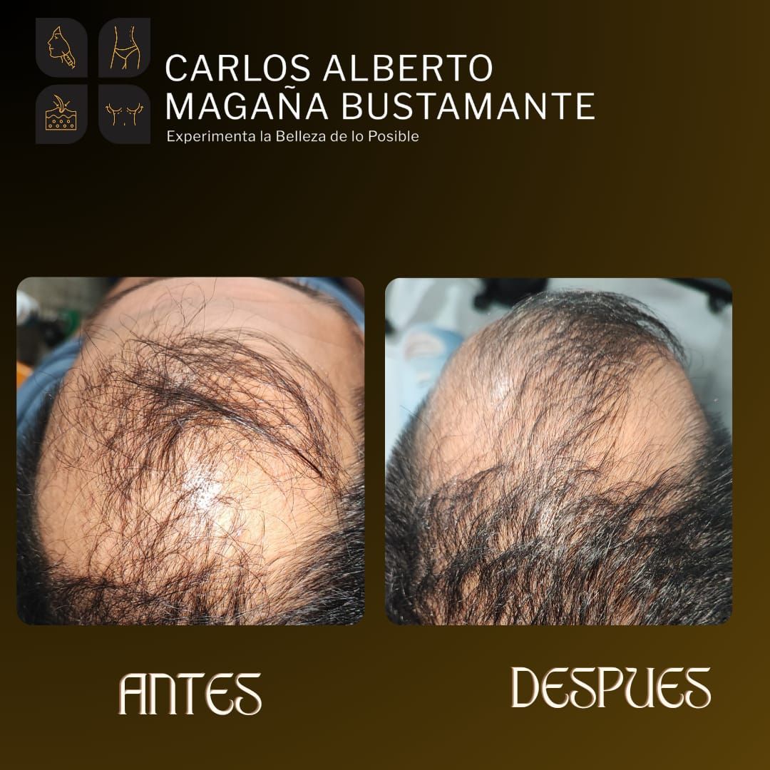 Carlos Alberto Magaña Bustamante-27