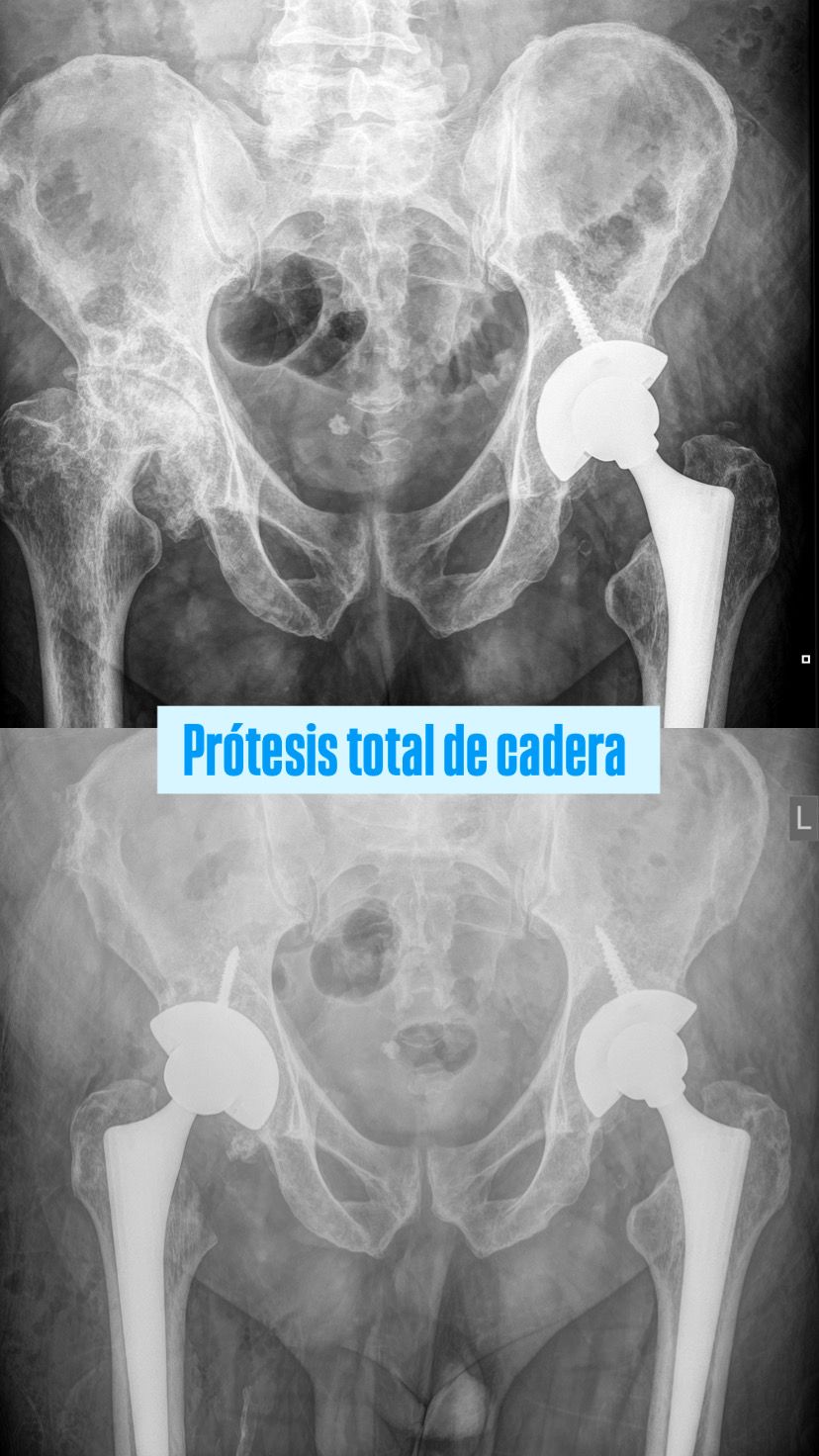 Juan Pablo Torres Nilo-1