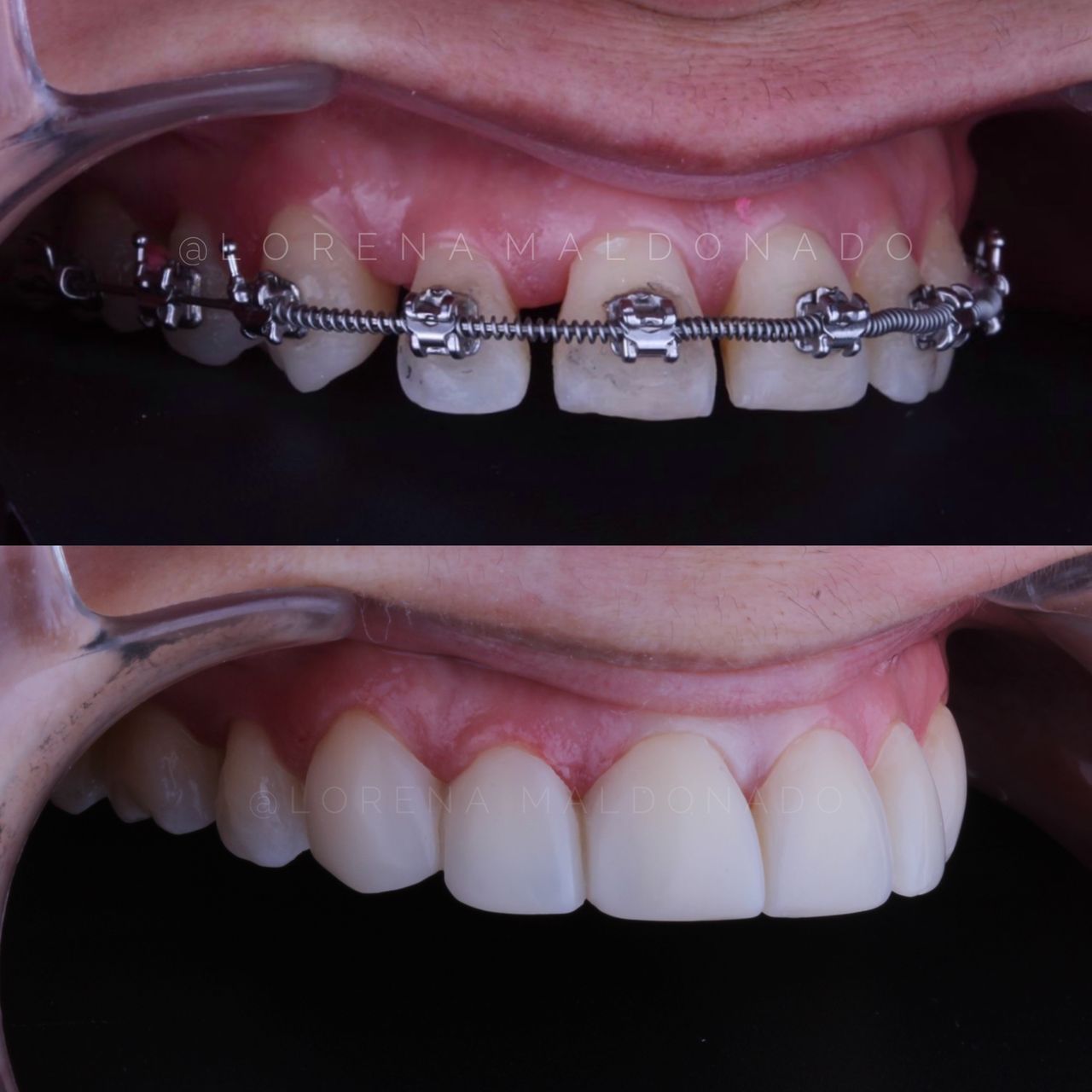 Ana Lorena Maldonado Munguia-3