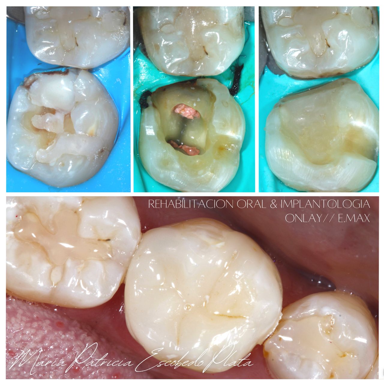 María Patricia Escobedo Plata-0