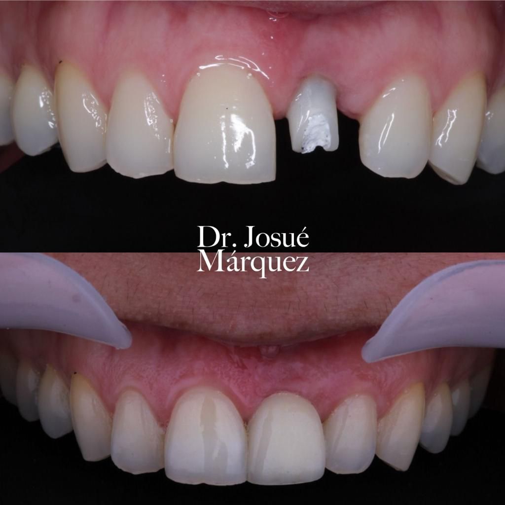 Josué Márquez Gómez-52